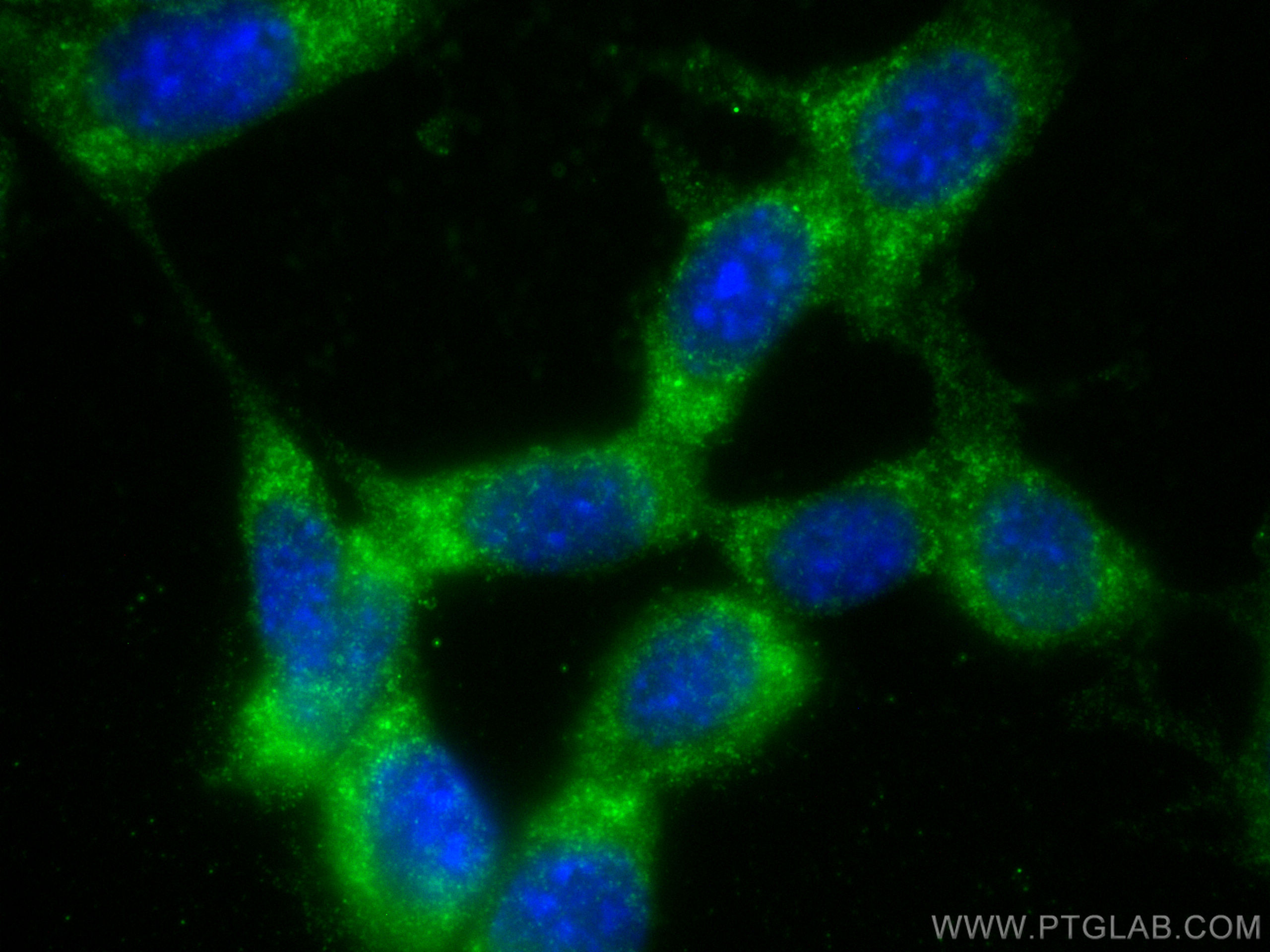 IF Staining of NIH/3T3 using 15152-1-AP