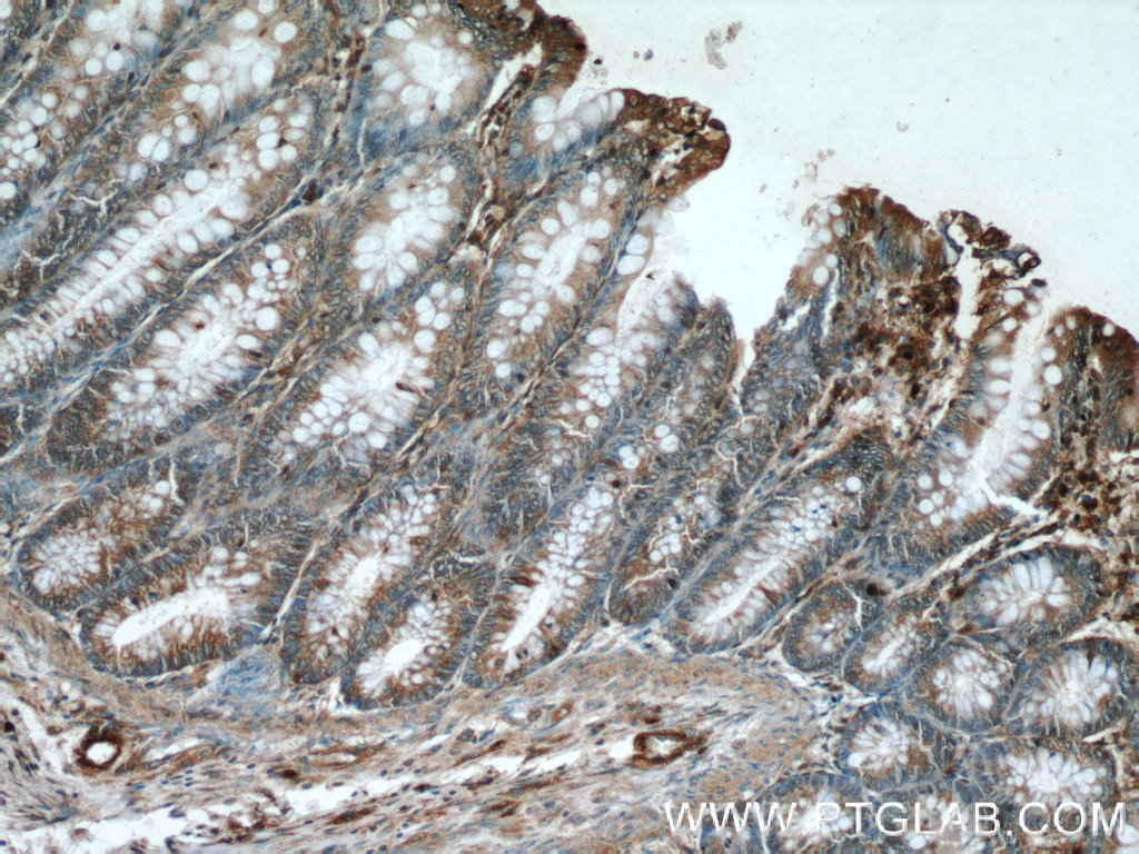 IHC staining of human colon using 24906-1-AP