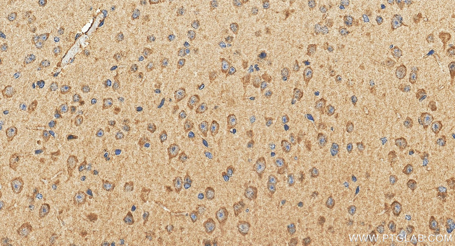 IHC staining of mouse brain using 24906-1-AP IHC staining of mouse brain using 24906-1-AP