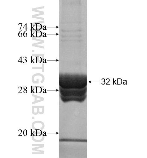 PROKR1 fusion protein Ag15838 SDS-PAGE PROKR1 fusion protein Ag15838 SDS-PAGE