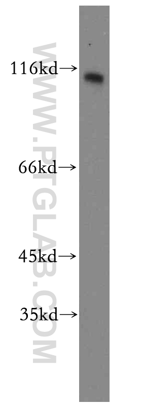 WB analysis of Y79 using 19945-1-AP