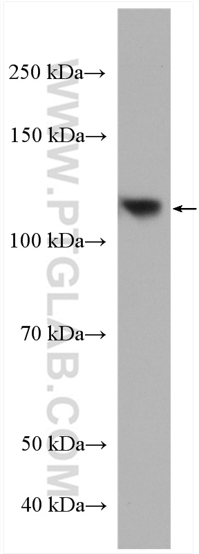 WB analysis of HT-29 using 19946-1-AP