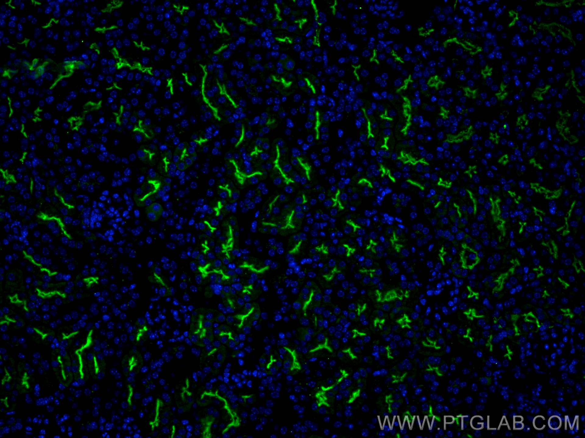 IF Staining of mouse kidney using 18470-1-AP