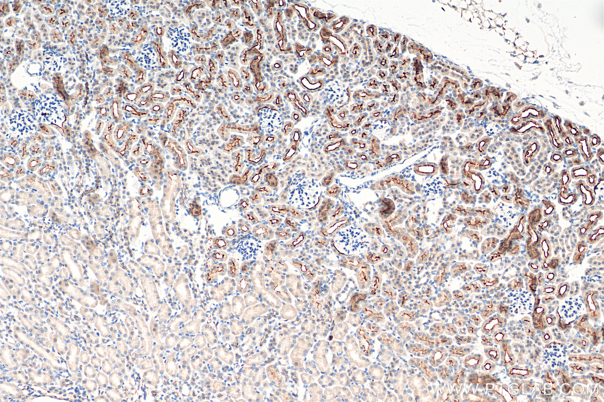 IHC staining of mouse kidney using 18470-1-AP