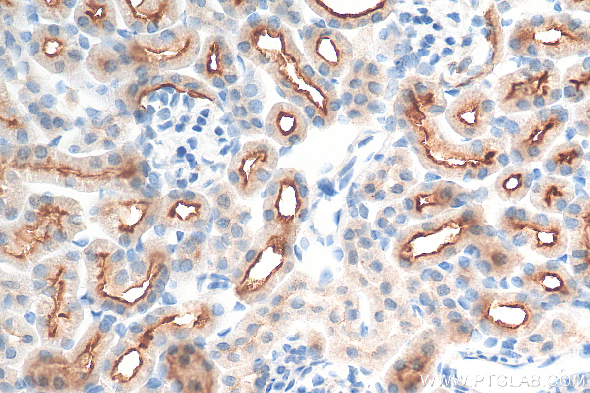 IHC staining of mouse kidney using 18470-1-AP