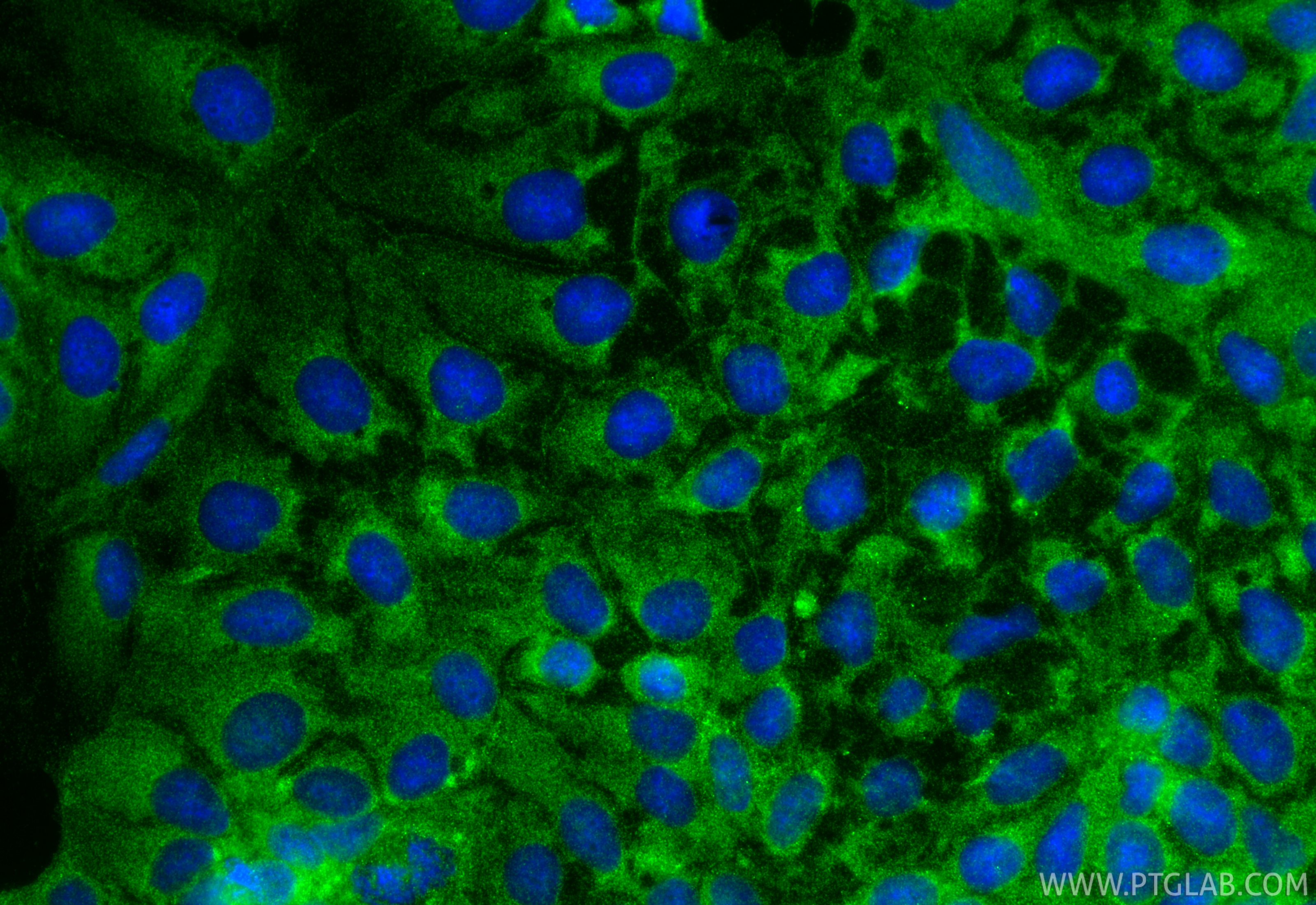 IF Staining of Caco-2 using 18495-1-AP IF Staining of Caco-2 using 18495-1-AP