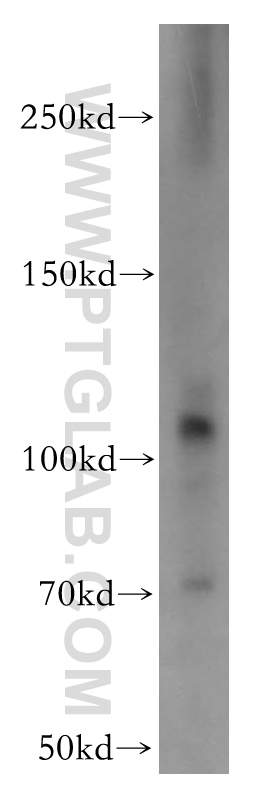 CD133 Polyclonal antibody