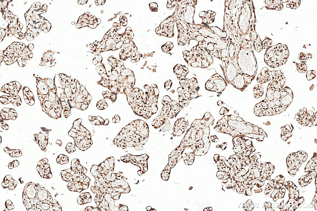 IHC staining of human placenta using 18739-1-AP (same clone as 18739-1-PBS)