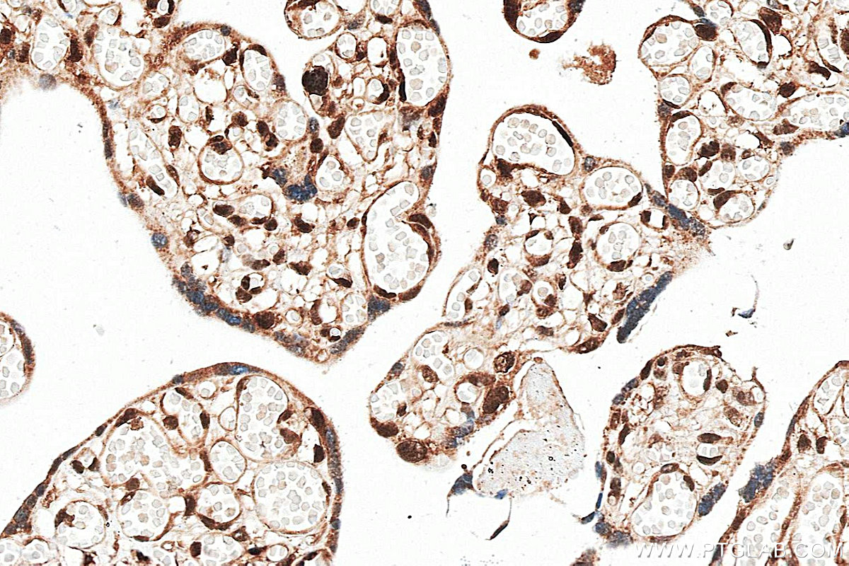 IHC staining of human placenta using 18739-1-AP (same clone as 18739-1-PBS)