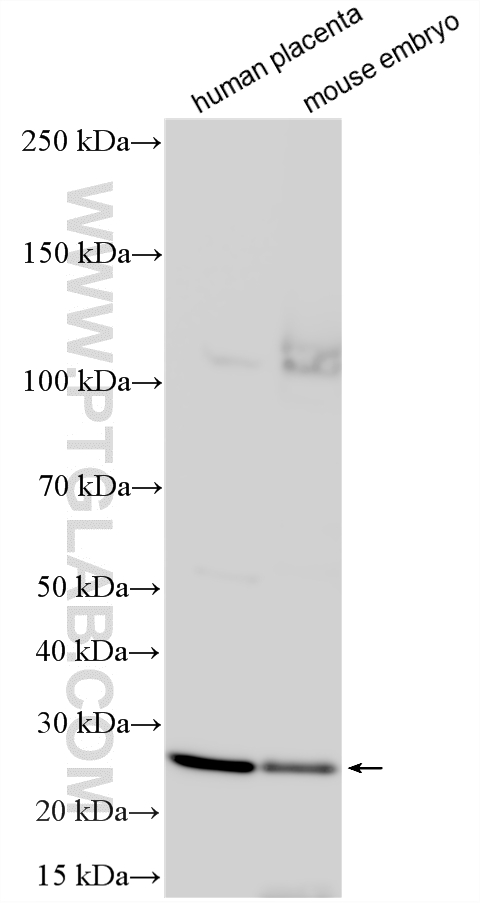 WB analysis using 18739-1-AP (same clone as 18739-1-PBS)