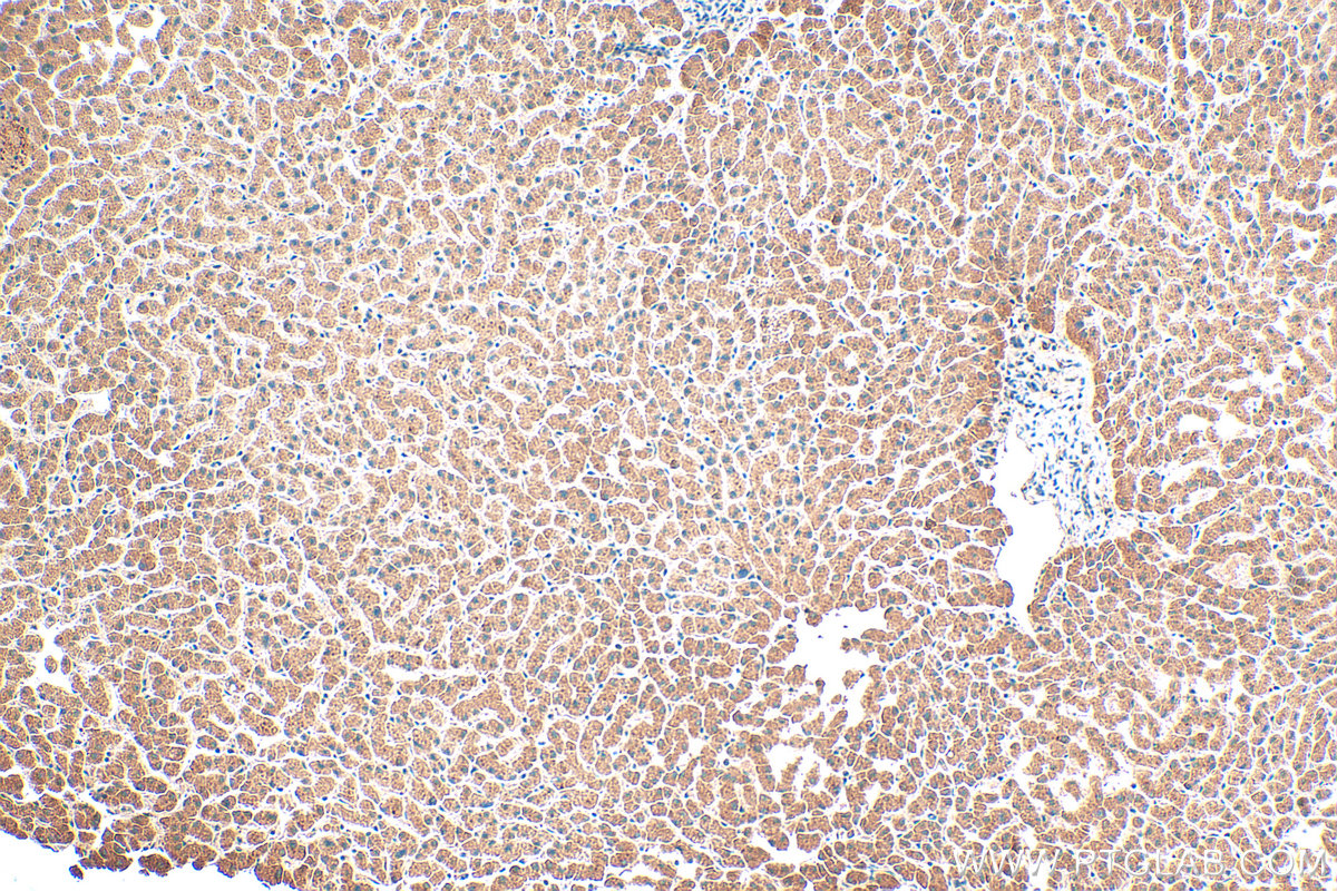 Immunohistochemical analysis of paraffin-embedded human liver tissue slide using 16910-1-AP (PROS1 antibody) at dilution of 1:400 (under 10x lens). Heat mediated antigen retrieval with Tris-EDTA buffer (pH 9.0). IHC staining of human liver using 16910-1-AP