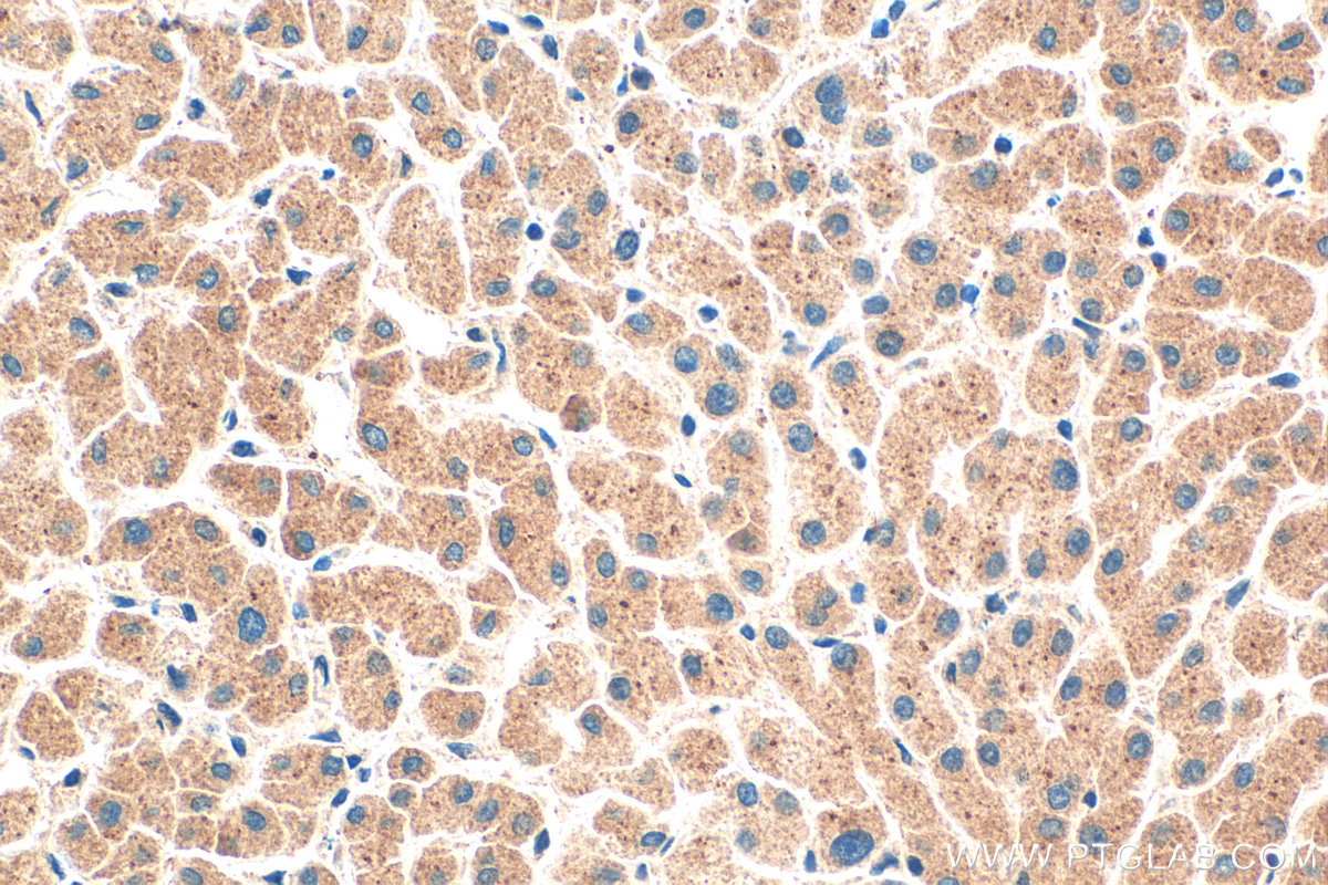 Immunohistochemical analysis of paraffin-embedded human liver tissue slide using 16910-1-AP (PROS1 antibody) at dilution of 1:400 (under 40x lens). Heat mediated antigen retrieval with Tris-EDTA buffer (pH 9.0). IHC staining of human liver using 16910-1-AP