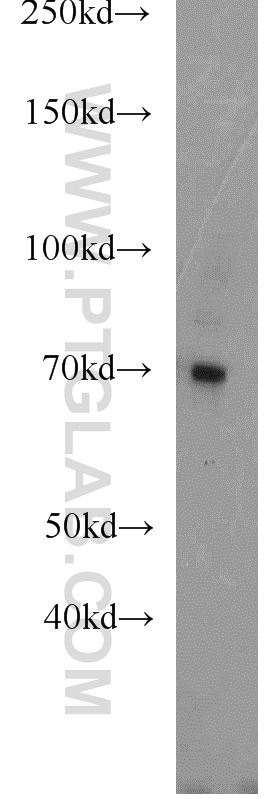 WB analysis of human placenta using 16910-1-AP