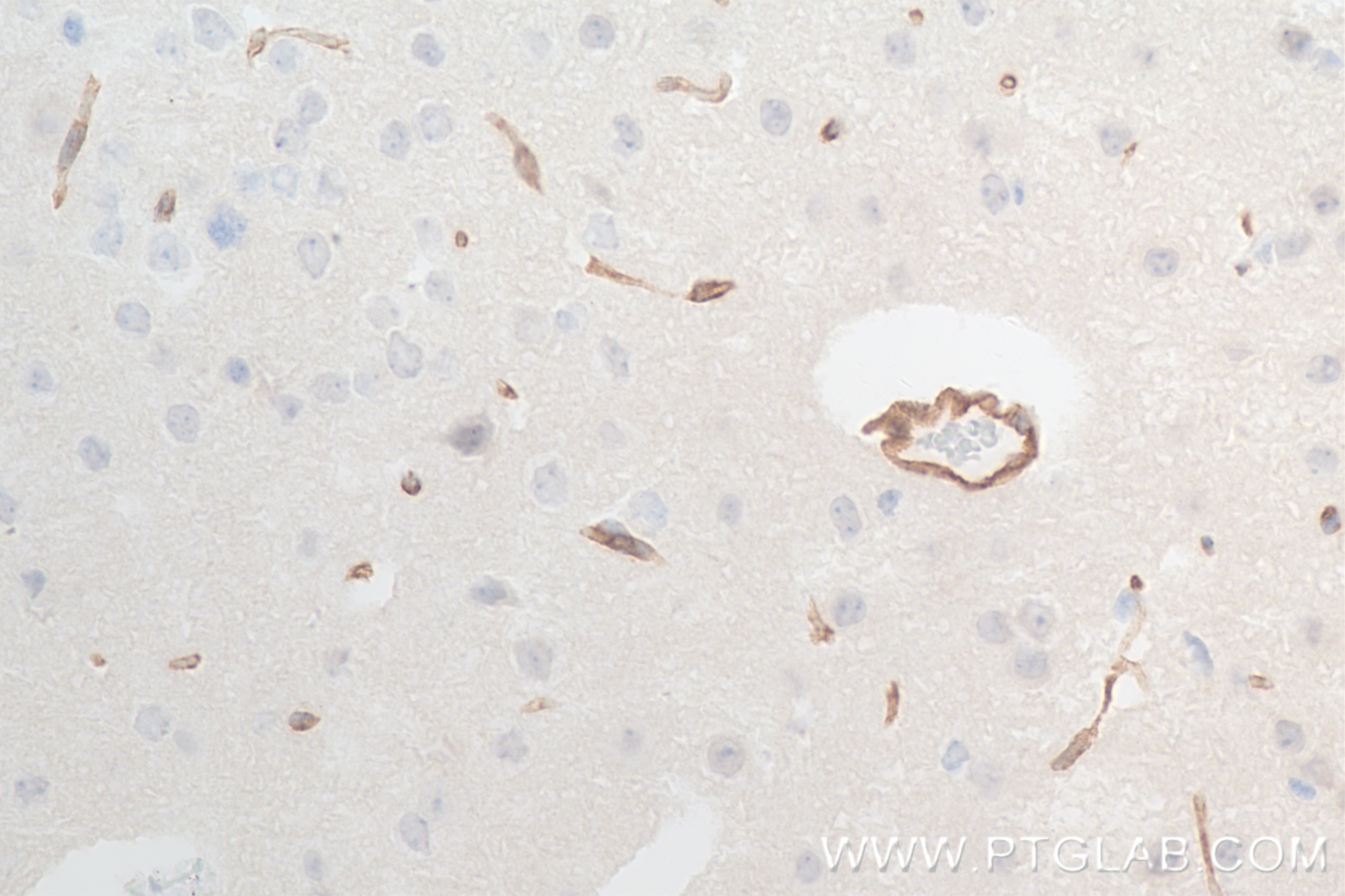 IHC staining of mouse brain using 84107-2-RR