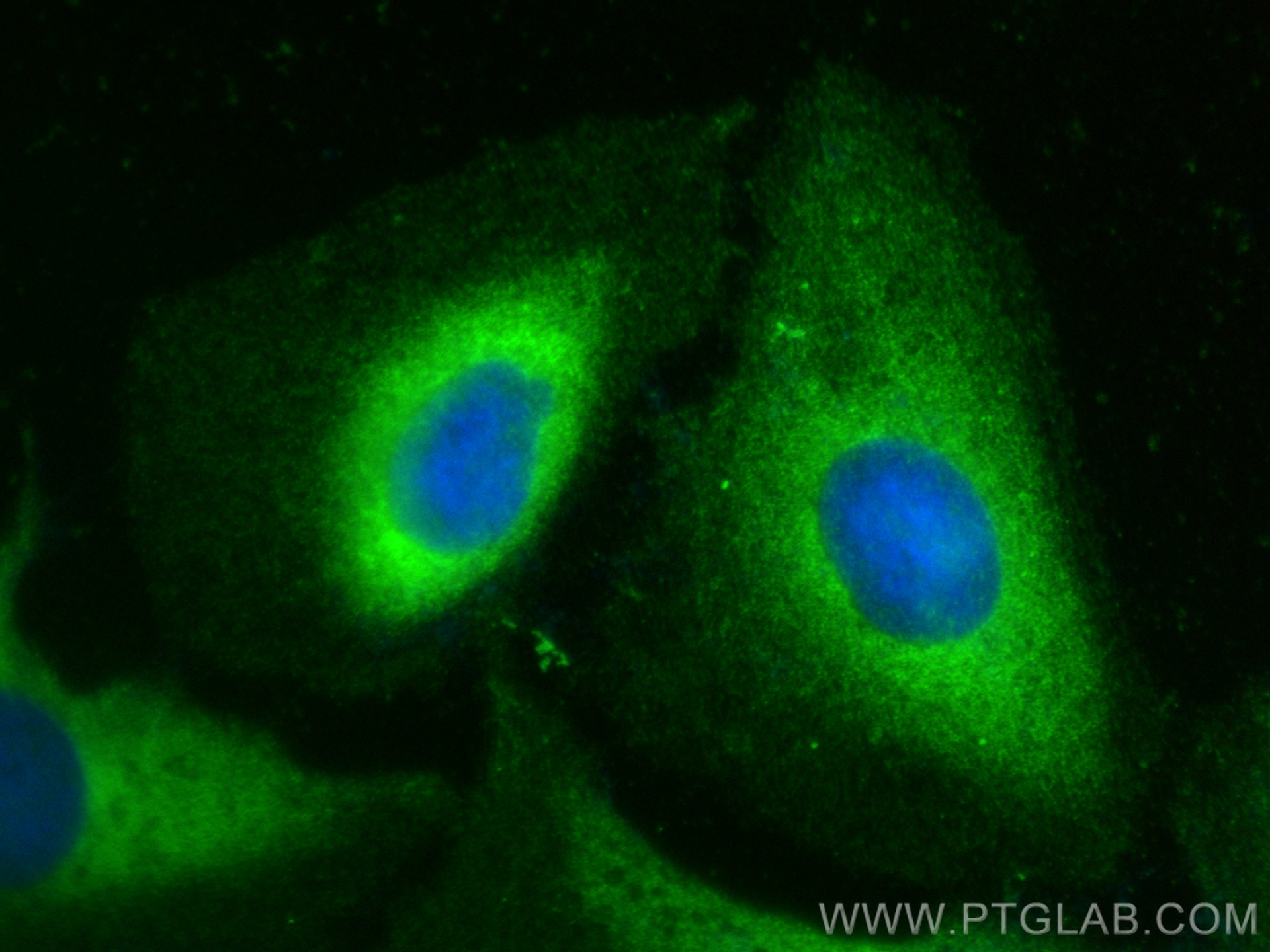 IF Staining of U2OS using 25154-1-AP