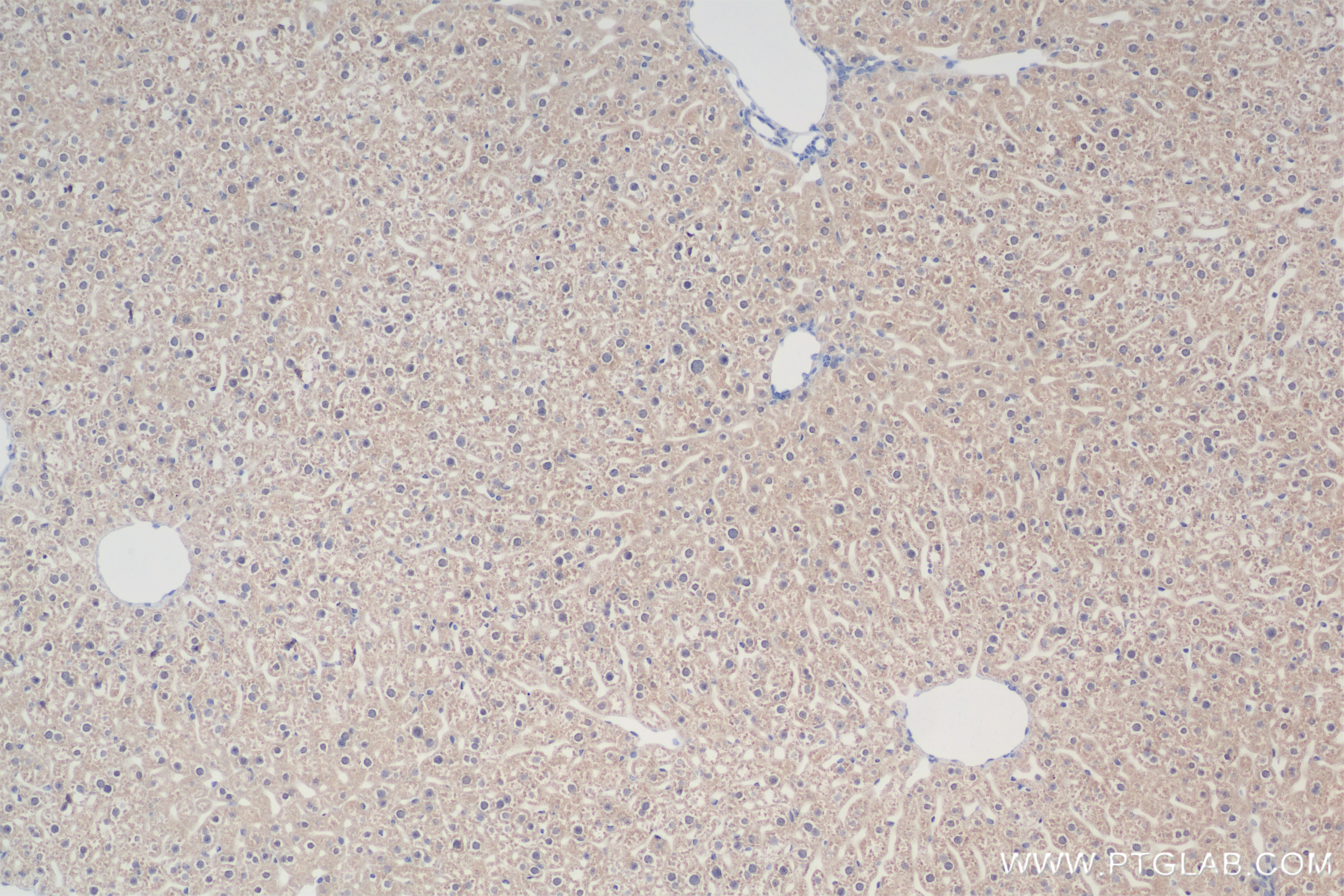 IHC staining of mouse liver using 83831-5-RR