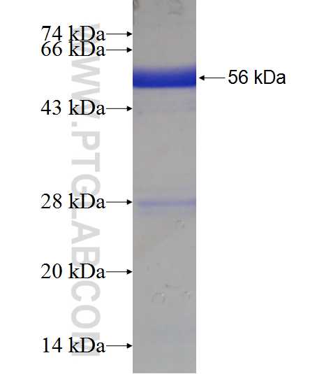 PROSC fusion protein Ag18369 SDS-PAGE