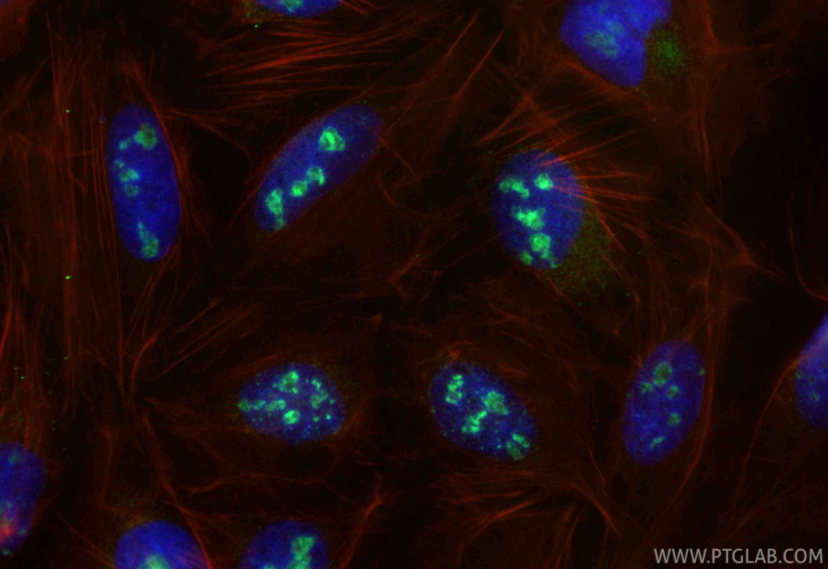 IF Staining of U2OS using 31494-1-AP (same clone as 31494-1-PBS) IF Staining of U2OS using 31494-1-AP (same clone as 31494-1-PBS)