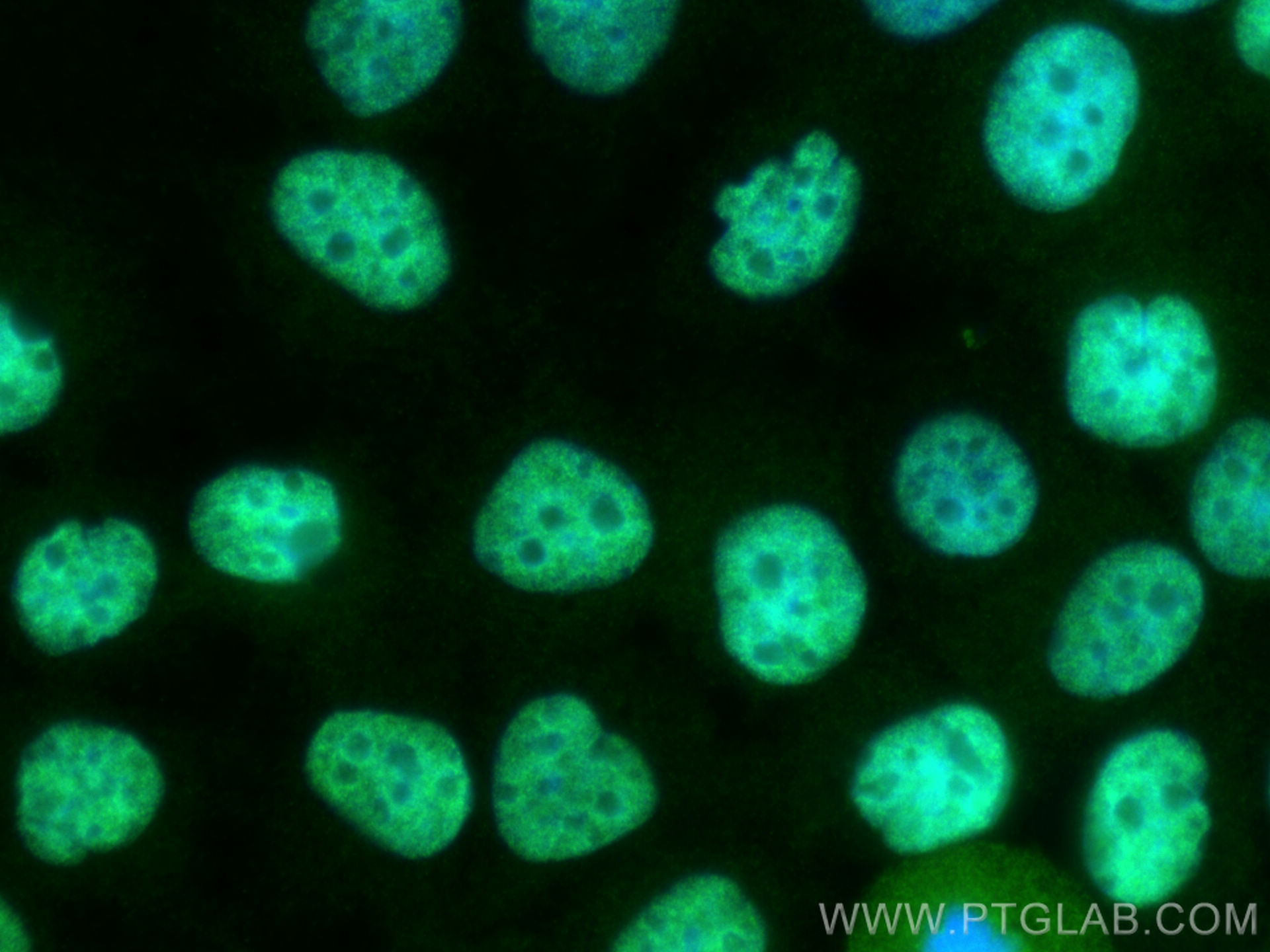 IF Staining of HuH-7 using 11067-2-AP