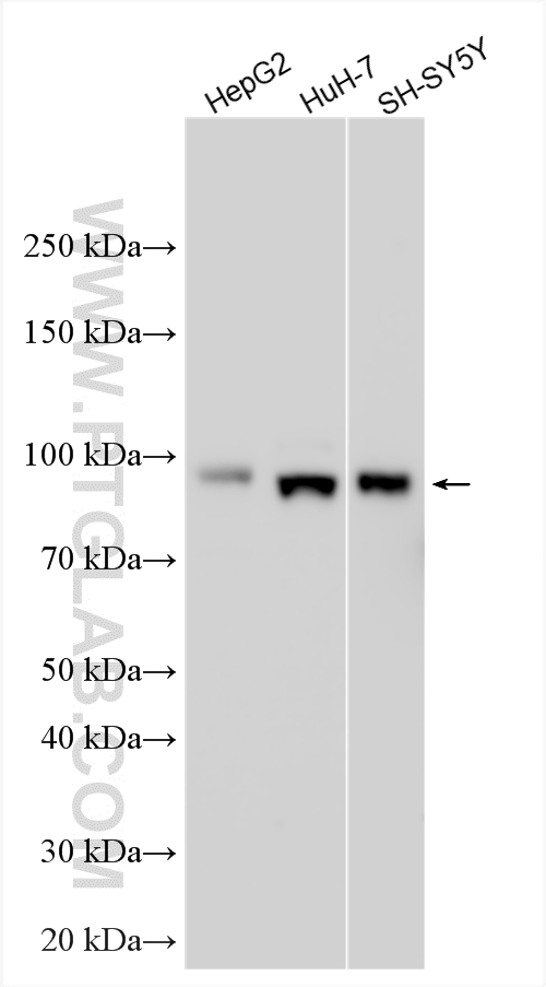 WB analysis using 11067-2-AP