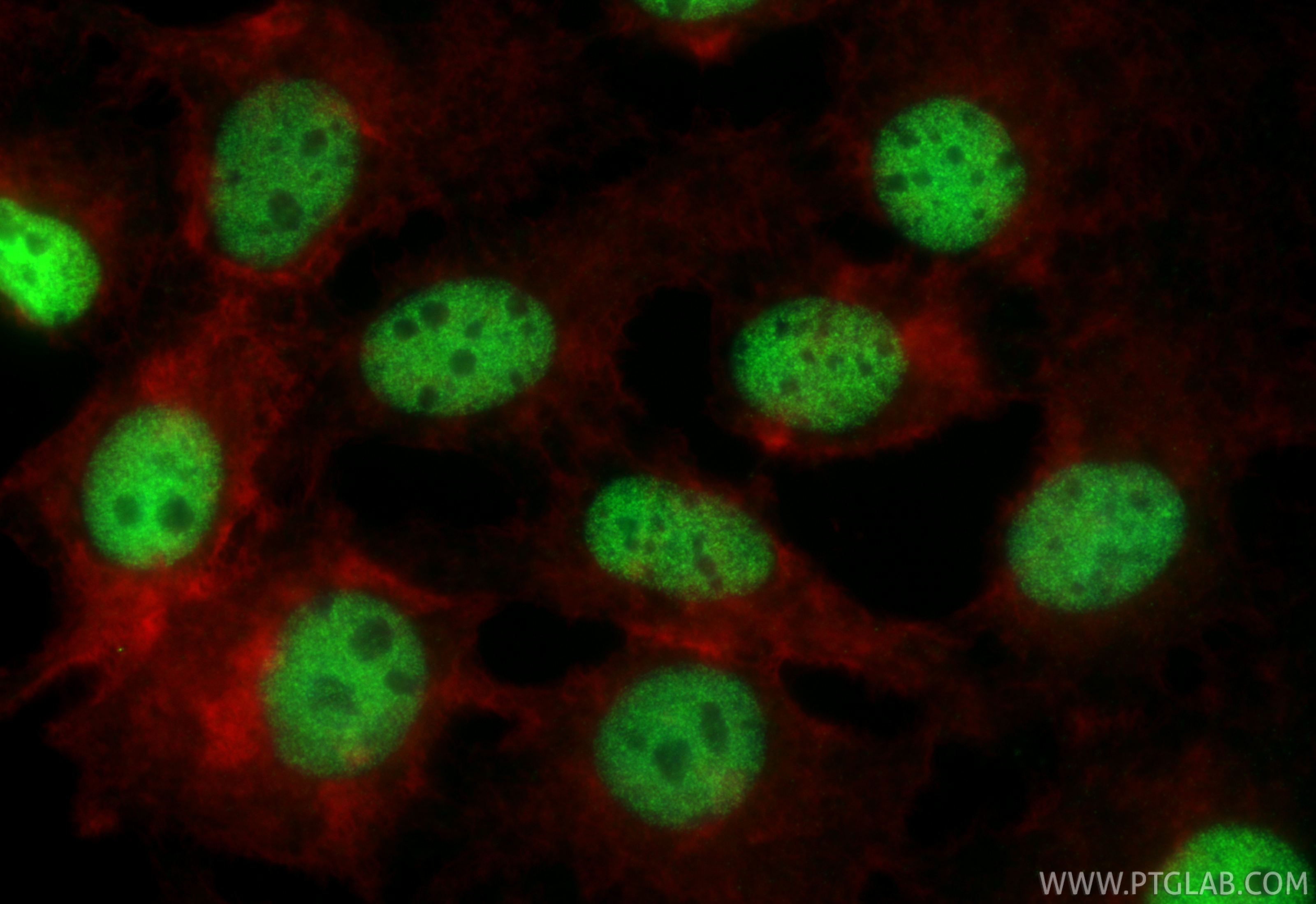 IF Staining of HuH-7 using 67438-1-Ig IF Staining of HuH-7 using 67438-1-Ig