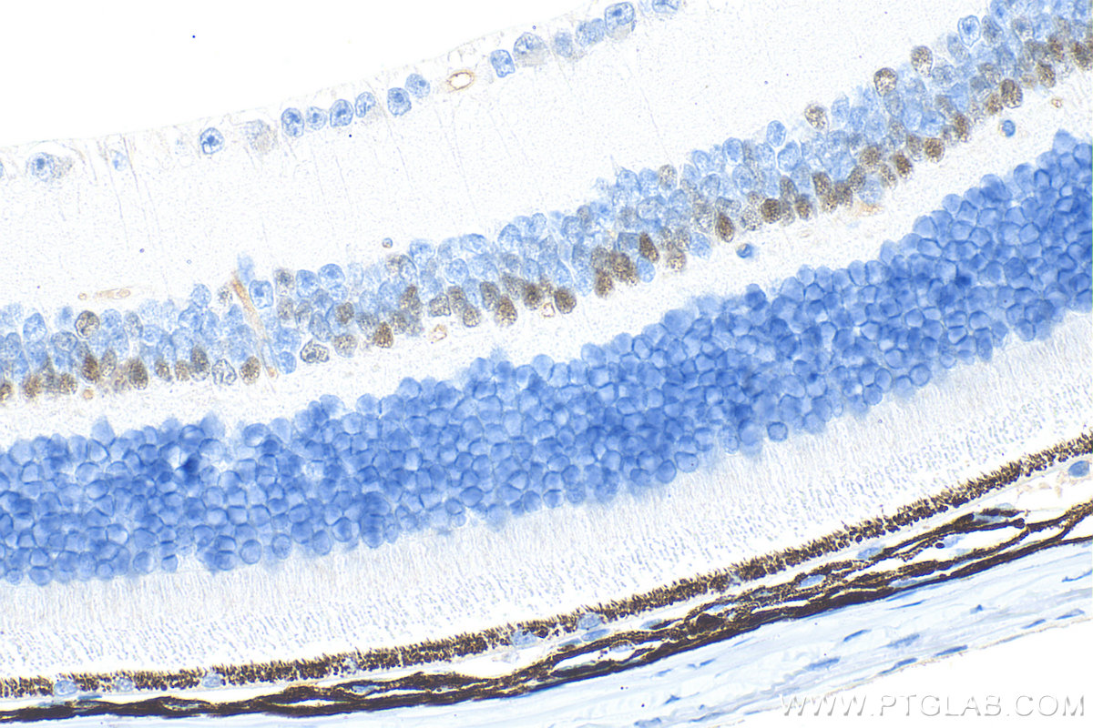 IHC staining of mouse eye using 67438-1-Ig