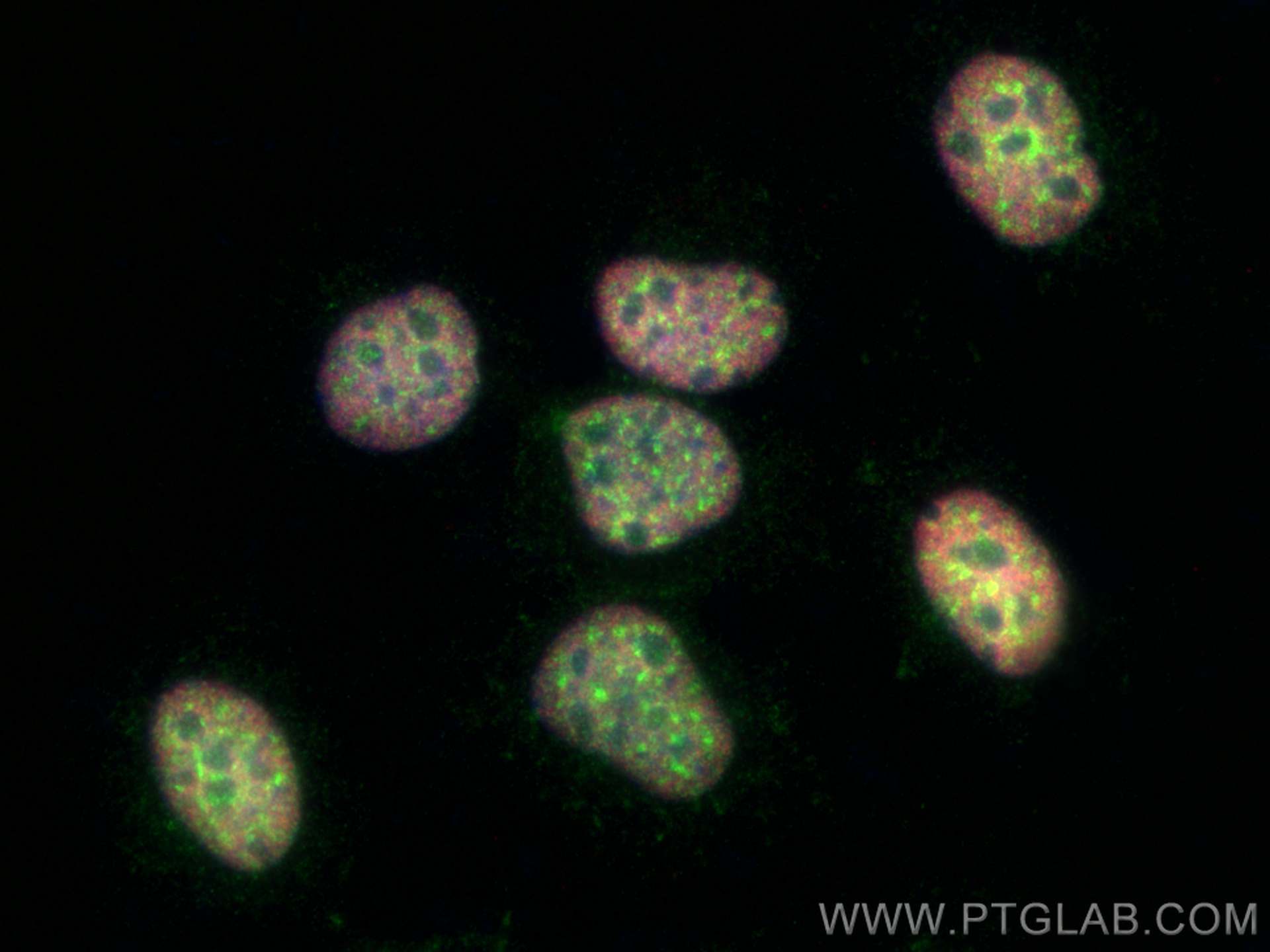 IF Staining of HuH-7 using 81778-1-RR (same clone as 81778-1-PBS)