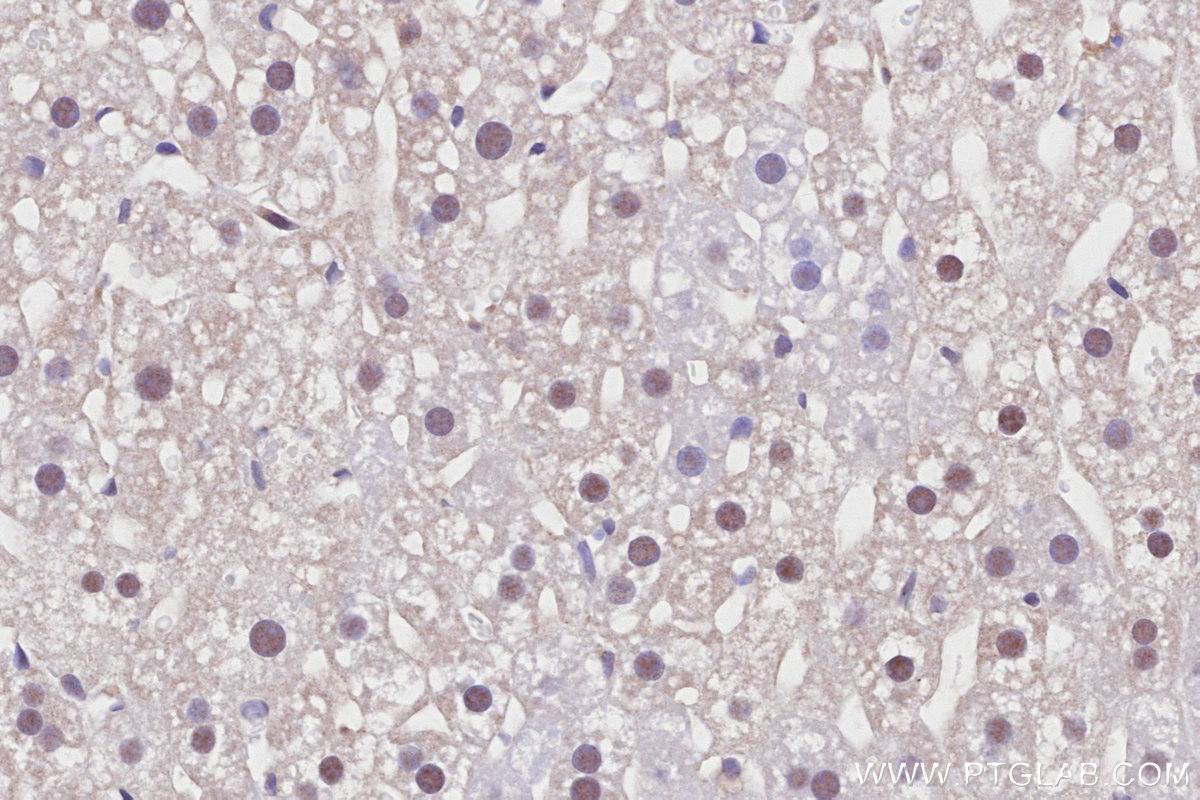 IHC staining of mouse liver using 81778-1-RR IHC staining of mouse liver using 81778-1-RR