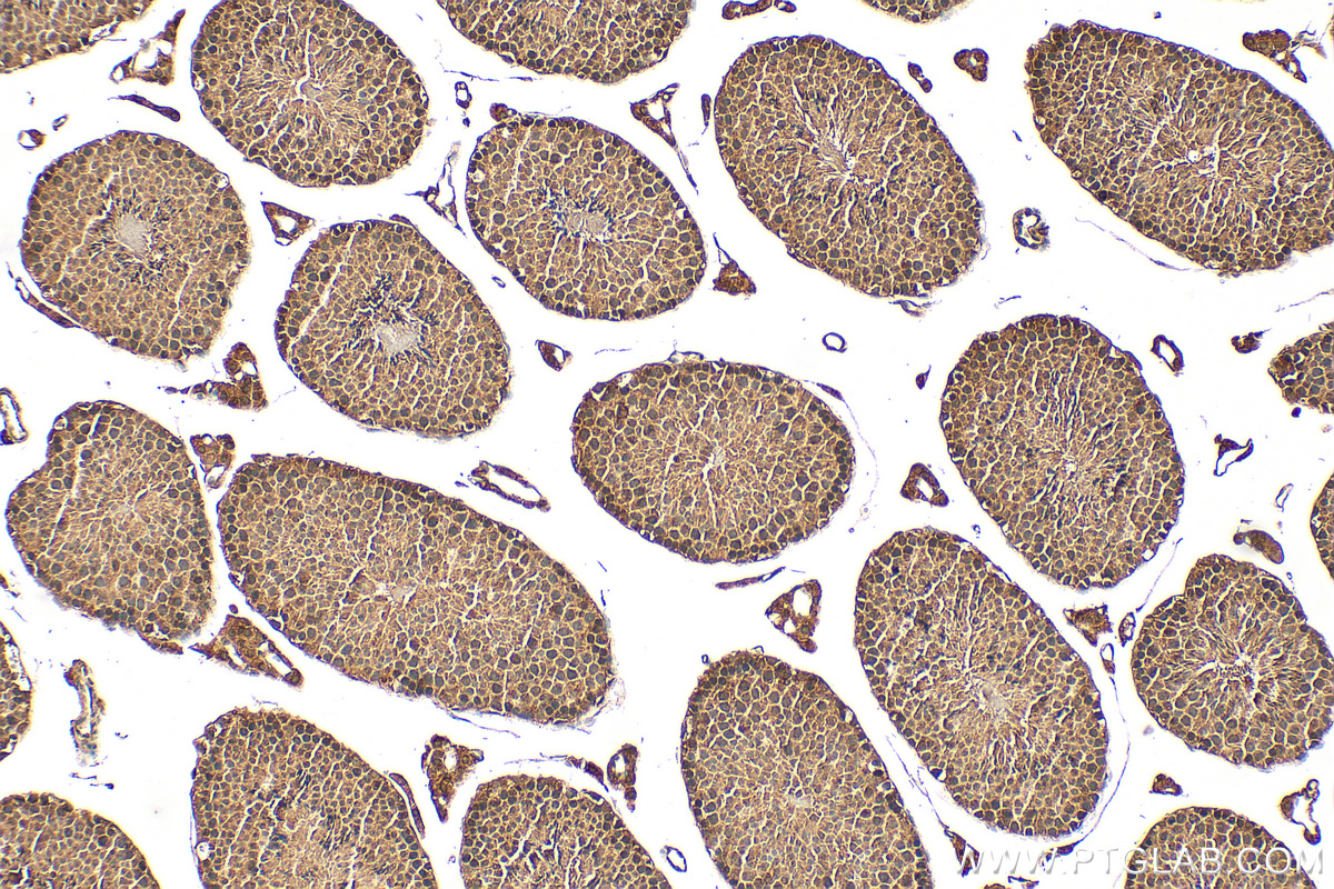 Immunohistochemical analysis of paraffin-embedded mouse testis tissue slide using 15414-1-AP (PRPF19 antibody) at dilution of 1:200 (under 10x lens). Heat mediated antigen retrieval with Tris-EDTA buffer (pH 9.0). IHC staining of mouse testis using 15414-1-AP