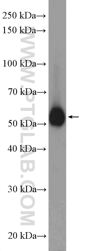 WB analysis of mouse kidney using 15414-1-AP