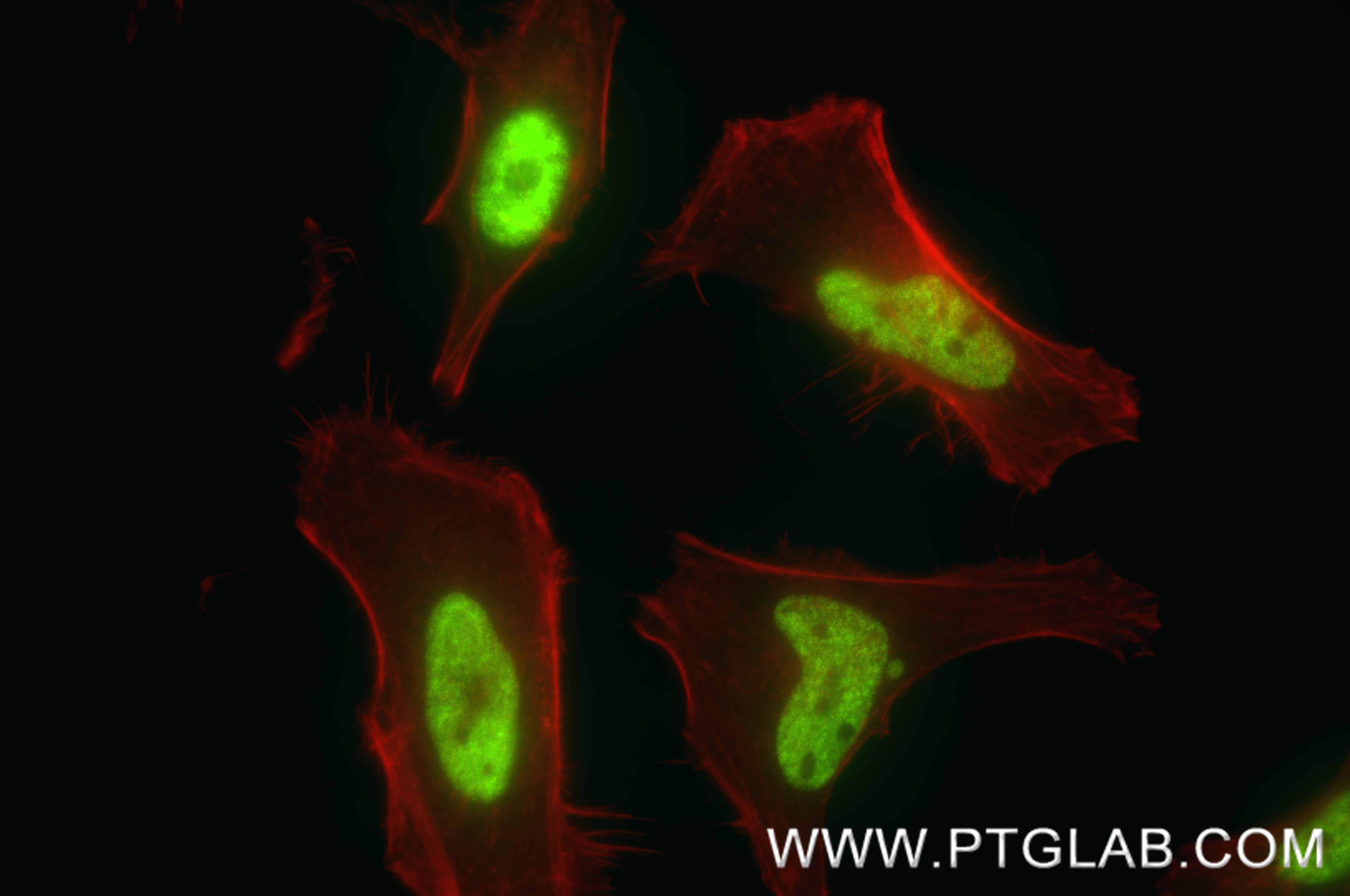 IF Staining of HeLa using 88331-1-RR IF Staining of HeLa using 88331-1-RR