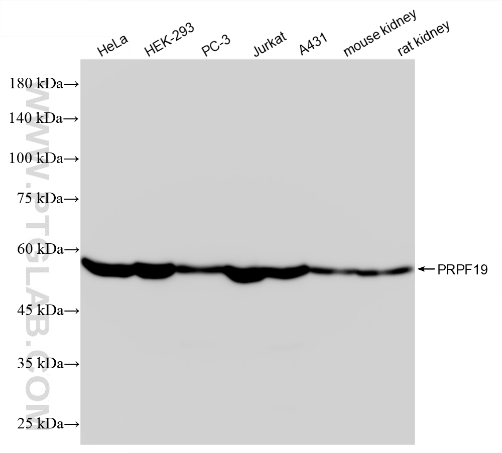 WB analysis using 88331-1-RR WB analysis using 88331-1-RR