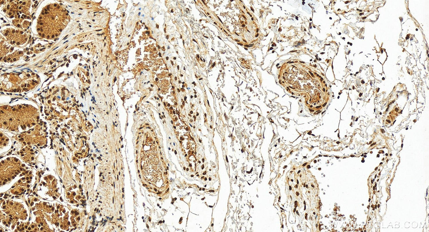 IHC staining of human stomach using 10106-1-AP