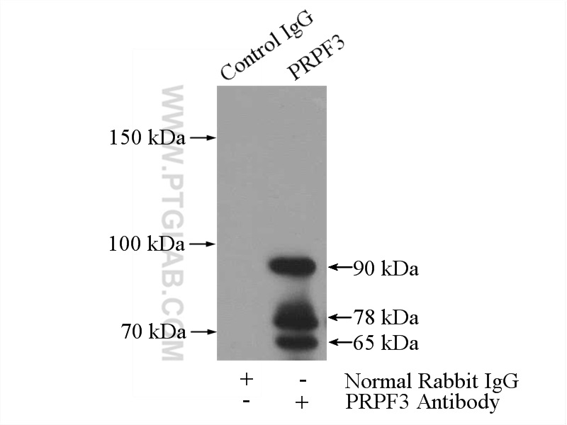 IP experiment of mouse liver using 10106-1-AP