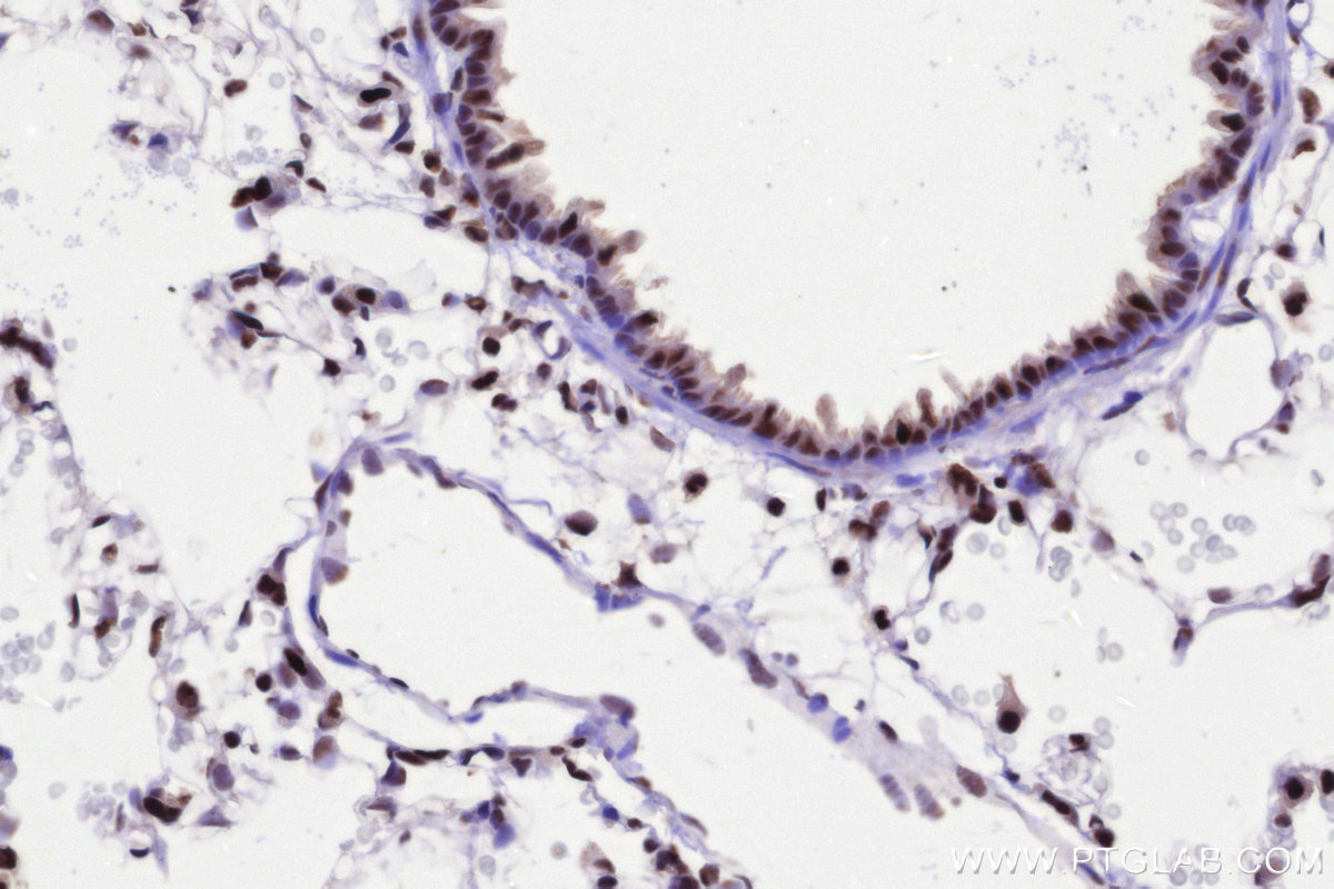 IHC staining of rat lung using 86315-1-RR