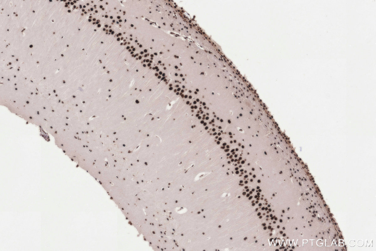 IHC staining of rat brain using 86315-1-RR