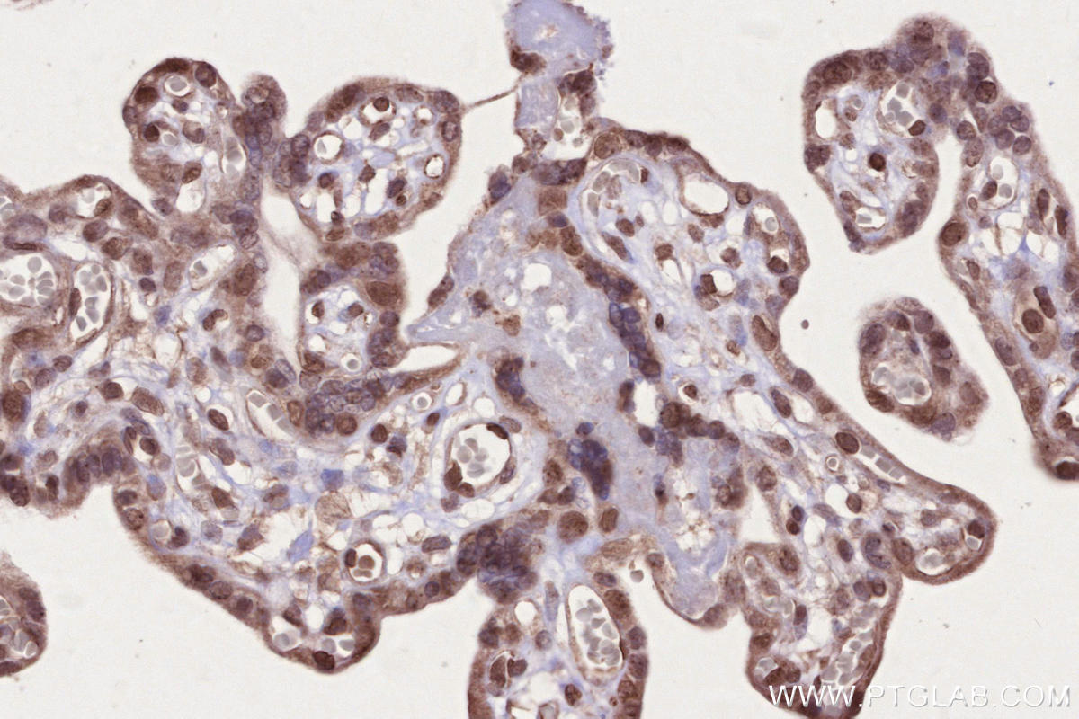 IHC staining of human placenta using 24946-1-AP IHC staining of human placenta using 24946-1-AP