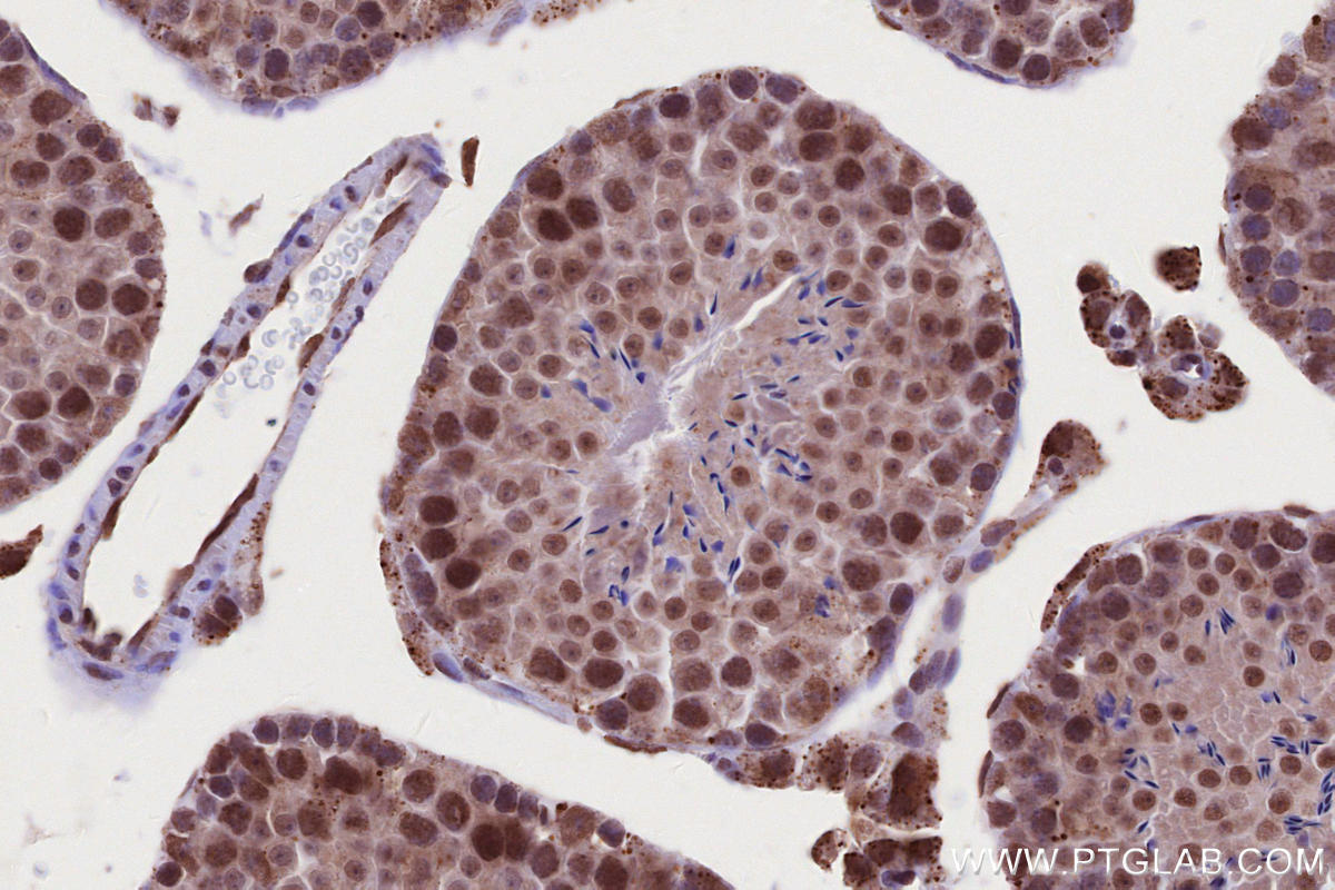 IHC staining of mouse testis using 24946-1-AP IHC staining of mouse testis using 24946-1-AP