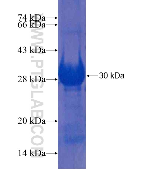 PRPF38B fusion protein Ag20986 SDS-PAGE PRPF38B fusion protein Ag20986 SDS-PAGE