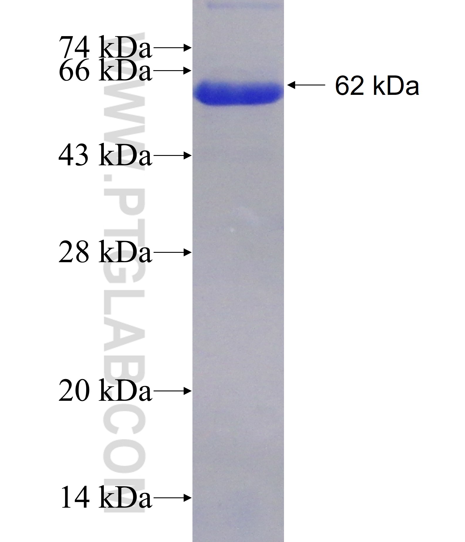 PRPF39 fusion protein Ag21683 SDS-PAGE