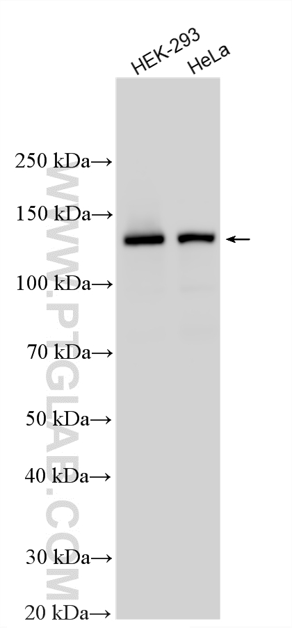 Various lysates were subjected to SDS PAGE followed by western blot with 17392-1-AP (PRPF40A antibody) at dilution of 1:3000 incubated at room temperature for 1.5 hours. WB analysis using 17392-1-AP