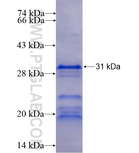 PRPF40A fusion protein Ag11159 SDS-PAGE PRPF40A fusion protein Ag11159 SDS-PAGE