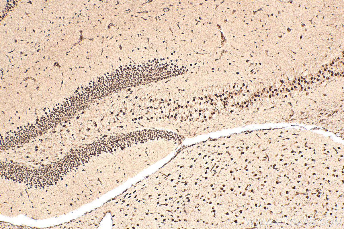 IHC staining of mouse brain using 16929-1-AP