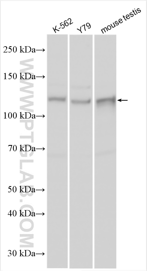 WB analysis using 16929-1-AP