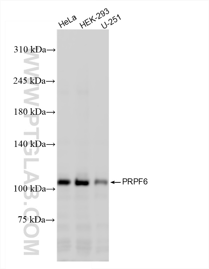 WB analysis using 86123-1-RR (same clone as 86123-1-PBS)