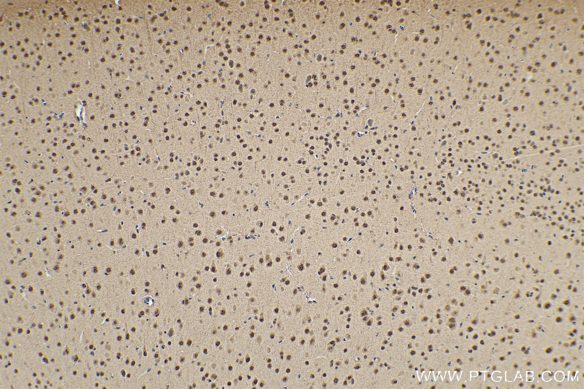 IHC staining of mouse brain using 11171-1-AP (same clone as 11171-1-PBS)