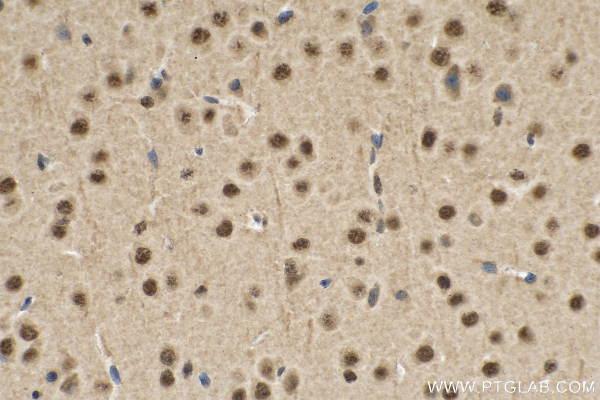 IHC staining of mouse brain using 11171-1-AP (same clone as 11171-1-PBS)