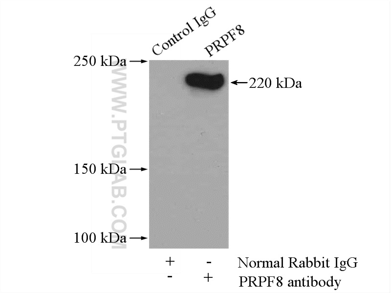 IP experiment of HeLa using 11171-1-AP (same clone as 11171-1-PBS)