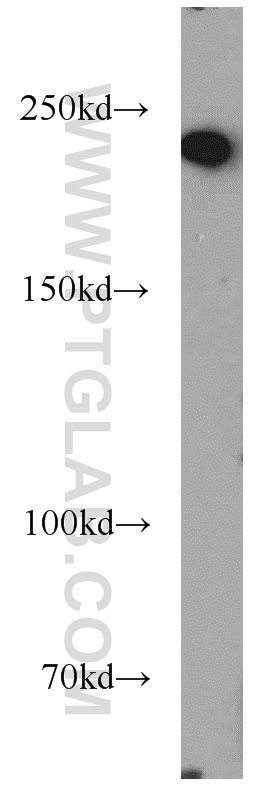 WB analysis of Jurkat using 11171-1-AP