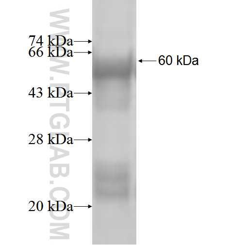 PRPF8 fusion protein Ag1652 SDS-PAGE